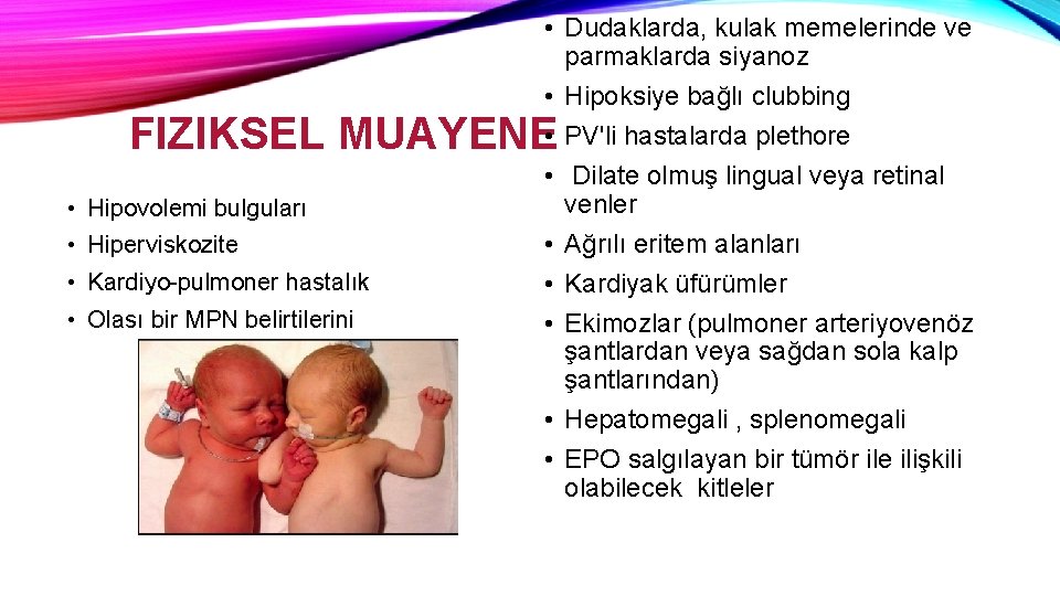  • Dudaklarda, kulak memelerinde ve parmaklarda siyanoz • Hipoksiye bağlı clubbing • PV'li