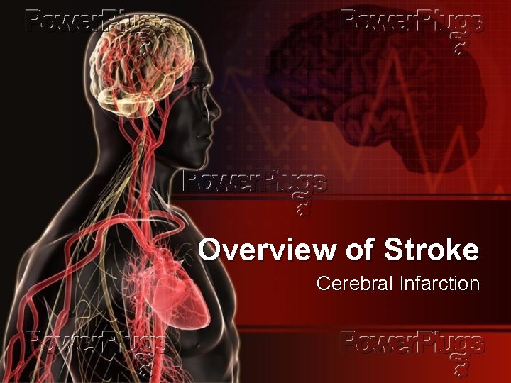 Overview of Stroke Cerebral Infarction 