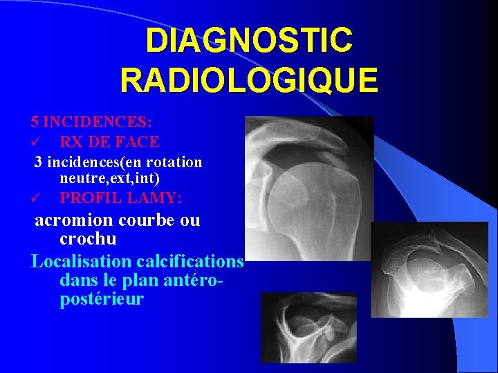 DIAGNOSTIC RADIOLOGIQUE 5 INCIDENCES: ü RX DE FACE 3 incidences(en rotation neutre, ext, int)