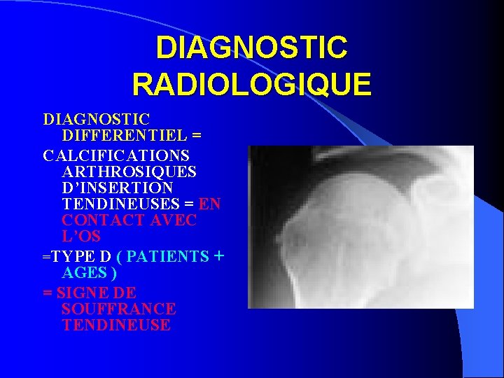 DIAGNOSTIC RADIOLOGIQUE DIAGNOSTIC DIFFERENTIEL = CALCIFICATIONS ARTHROSIQUES D’INSERTION TENDINEUSES = EN CONTACT AVEC L’OS