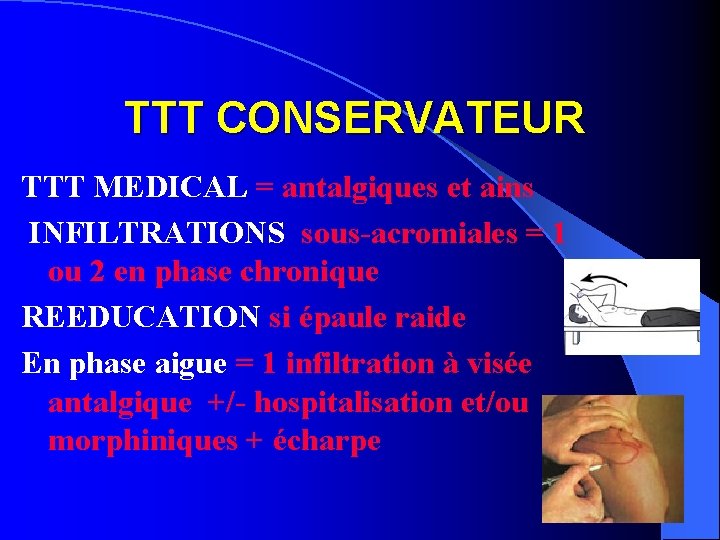 TTT CONSERVATEUR TTT MEDICAL = antalgiques et ains INFILTRATIONS sous-acromiales = 1 ou 2