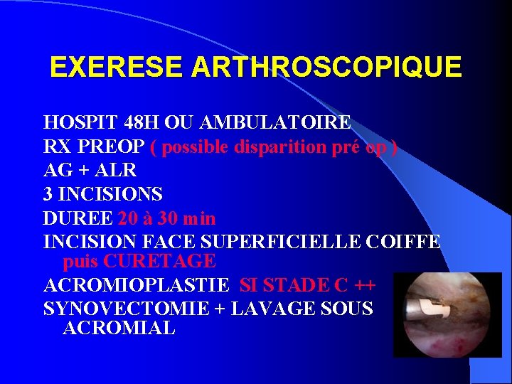 EXERESE ARTHROSCOPIQUE HOSPIT 48 H OU AMBULATOIRE RX PREOP ( possible disparition pré op