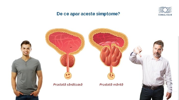 De ce apar aceste simptome? Prostată sănătoasă www. coral-club. com Prostată mărită 