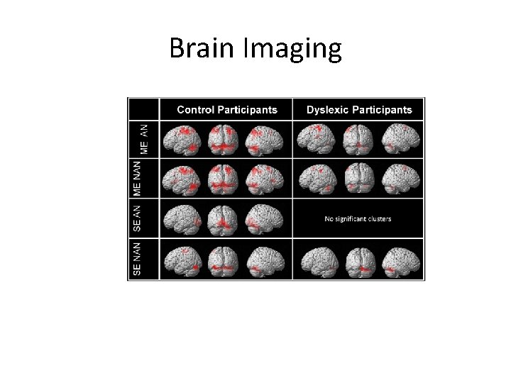 Brain Imaging 