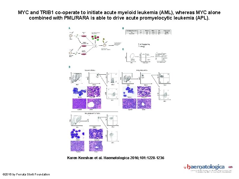 MYC and TRIB 1 co-operate to initiate acute myeloid leukemia (AML), whereas MYC alone