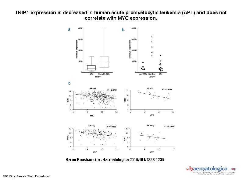 TRIB 1 expression is decreased in human acute promyelocytic leukemia (APL) and does not