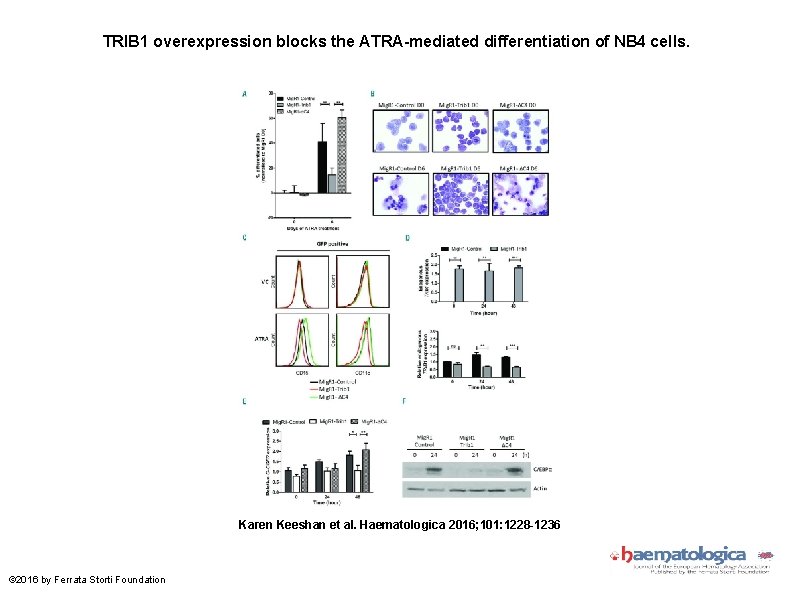TRIB 1 overexpression blocks the ATRA-mediated differentiation of NB 4 cells. Karen Keeshan et