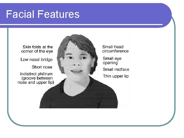 Facial Features Facial Features