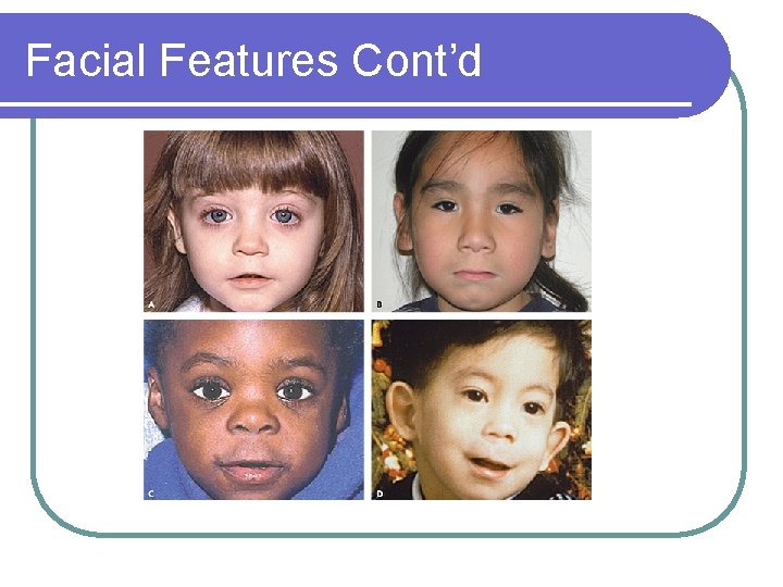 Facial Features Cont’d Facial Features Cont’d