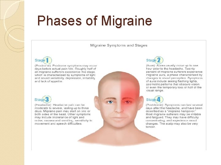 Phases of Migraine 
