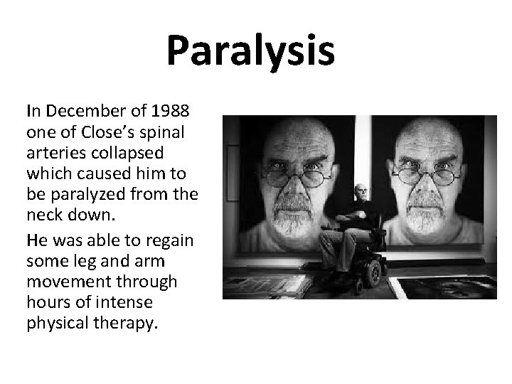 Paralysis In December of 1988 one of Close’s spinal arteries collapsed which caused him