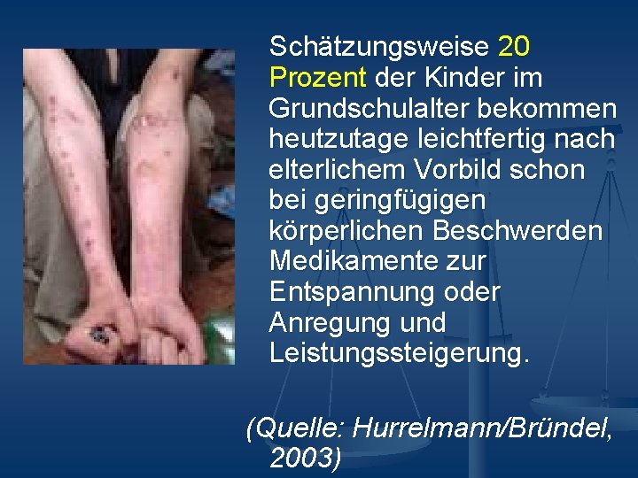 Schätzungsweise 20 Prozent der Kinder im Grundschulalter bekommen heutzutage leichtfertig nach elterlichem Vorbild schon