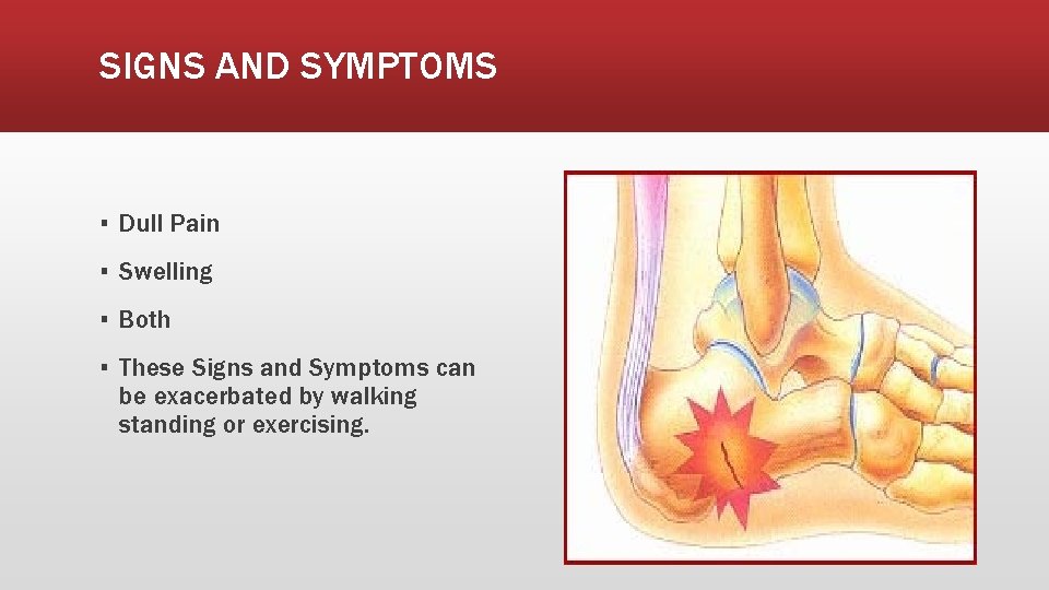 SIGNS AND SYMPTOMS ▪ Dull Pain ▪ Swelling ▪ Both ▪ These Signs and