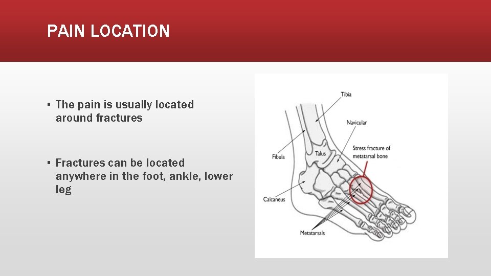 PAIN LOCATION ▪ The pain is usually located around fractures ▪ Fractures can be