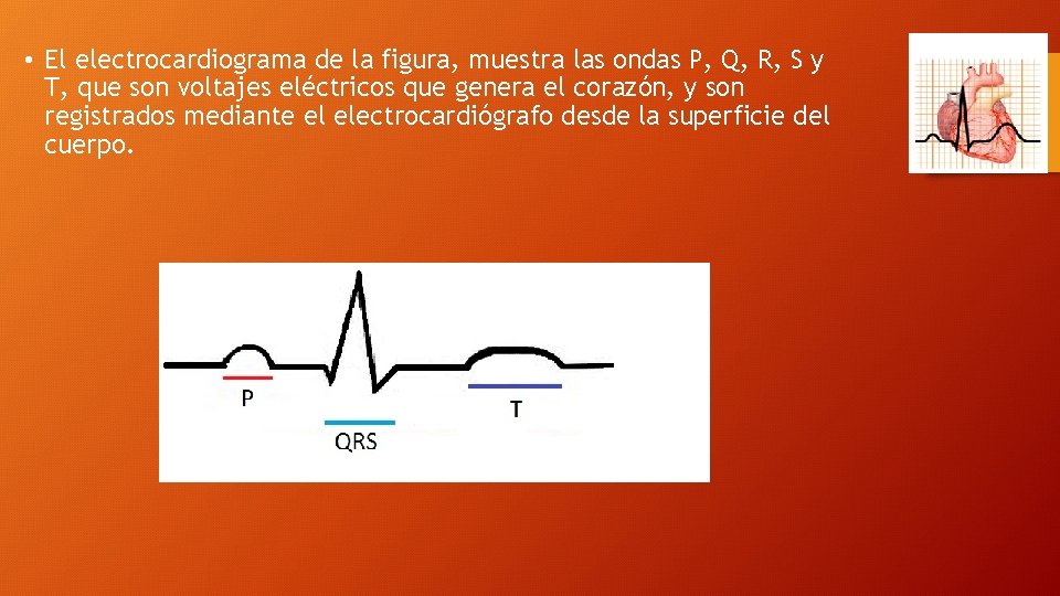  • El electrocardiograma de la figura, muestra las ondas P, Q, R, S