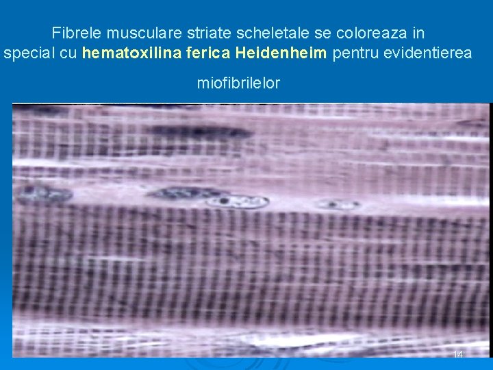 Fibrele musculare striate scheletale se coloreaza in special cu hematoxilina ferica Heidenheim pentru evidentierea