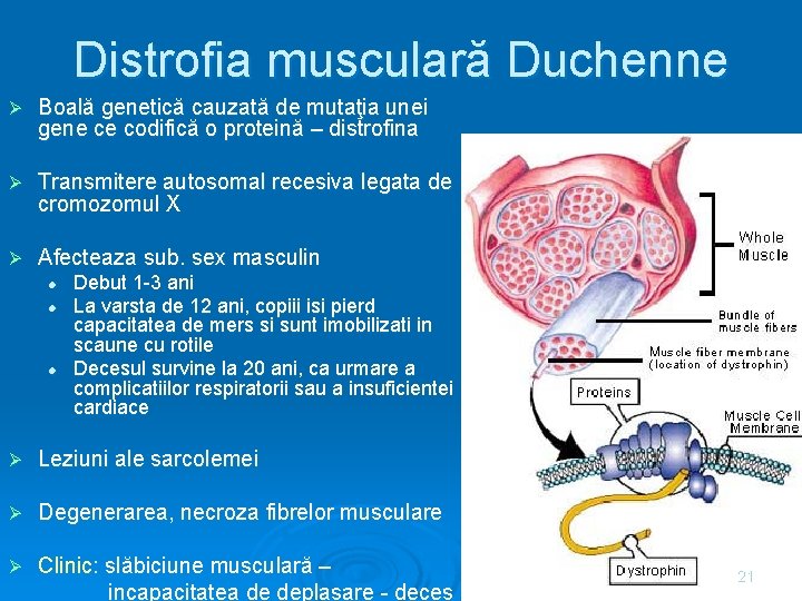 Distrofia musculară Duchenne Ø Boală genetică cauzată de mutaţia unei gene ce codifică o