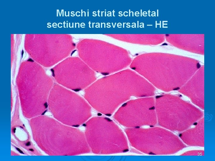 Muschi striat scheletal sectiune transversala – HE 35 