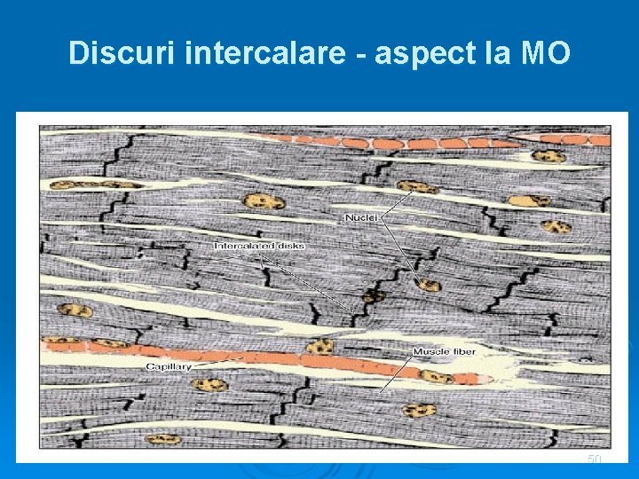 Discuri intercalare - aspect la MO 50 