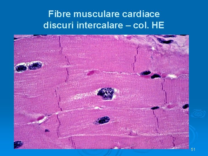 Fibre musculare cardiace discuri intercalare – col. HE 51 