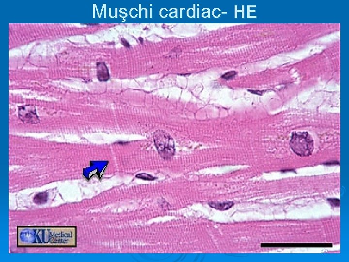 Muşchi cardiac- HE 57 