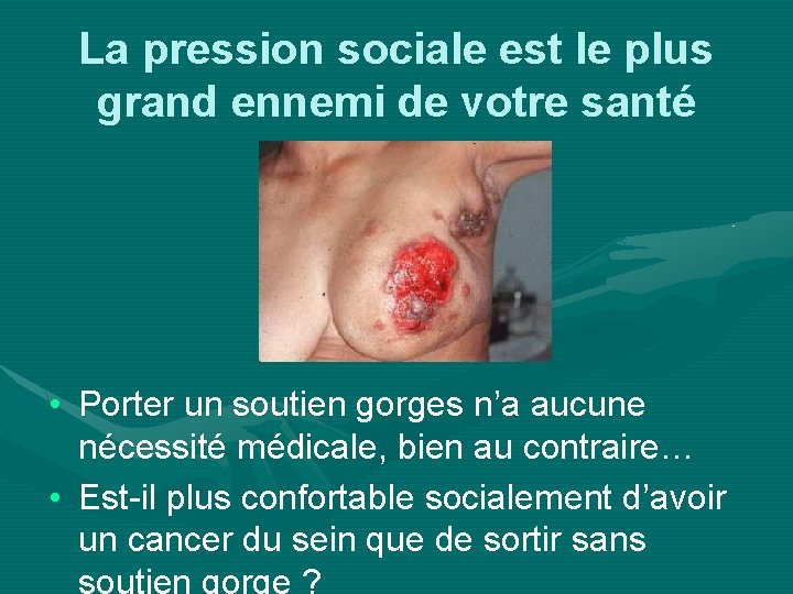 La pression sociale est le plus grand ennemi de votre santé • Porter un