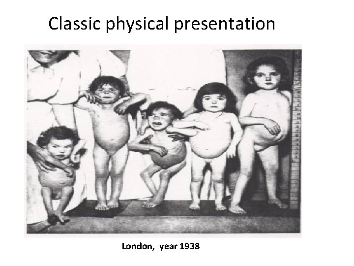 Classic physical presentation London, year 1938 