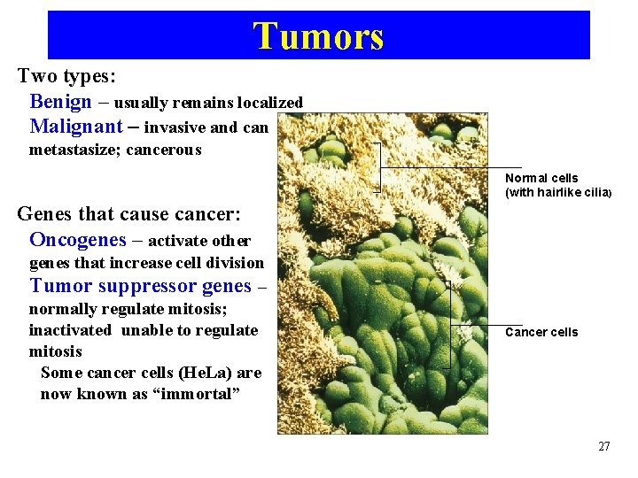 Tumors Two types: Benign – usually remains localized Malignant – invasive and can metastasize;