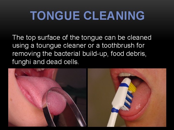 TONGUE CLEANING The top surface of the tongue can be cleaned using a toungue
