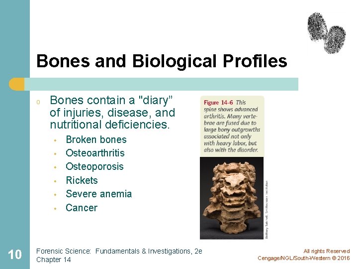 Bones and Biological Profiles o Bones contain a "diary” of injuries, disease, and nutritional