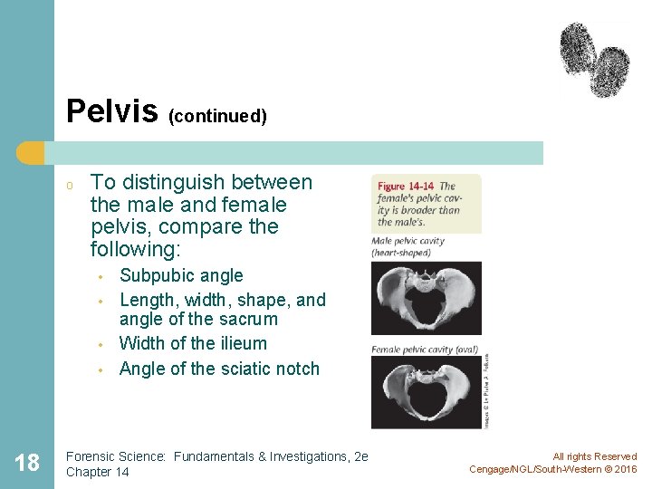 Pelvis (continued) o To distinguish between the male and female pelvis, compare the following: