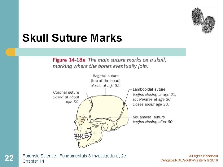 Skull Suture Marks 22 Forensic Science: Fundamentals & Investigations, 2 e Chapter 14 All