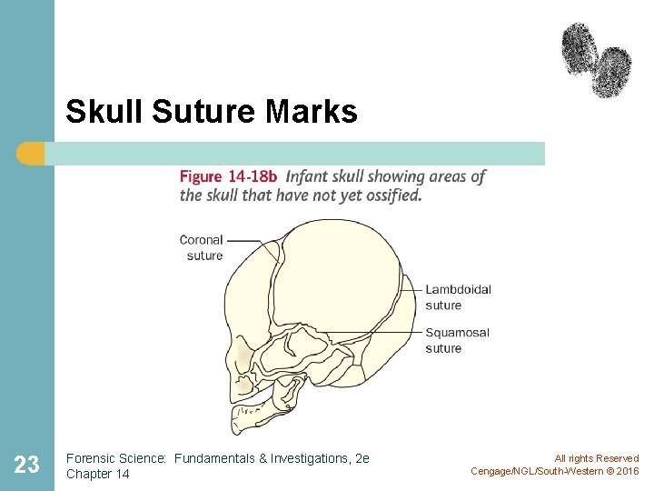 Skull Suture Marks 23 Forensic Science: Fundamentals & Investigations, 2 e Chapter 14 All