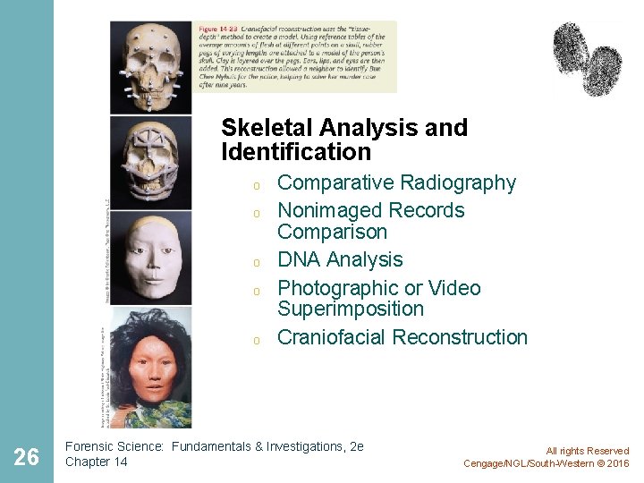 Skeletal Analysis and Identification o o o 26 Comparative Radiography Nonimaged Records Comparison DNA