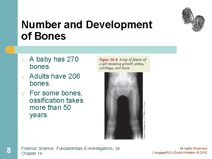 Number and Development of Bones o o o 8 A baby has 270 bones.