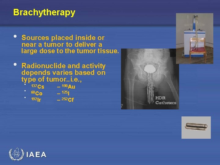 Brachytherapy • Sources placed inside or near a tumor to deliver a large dose