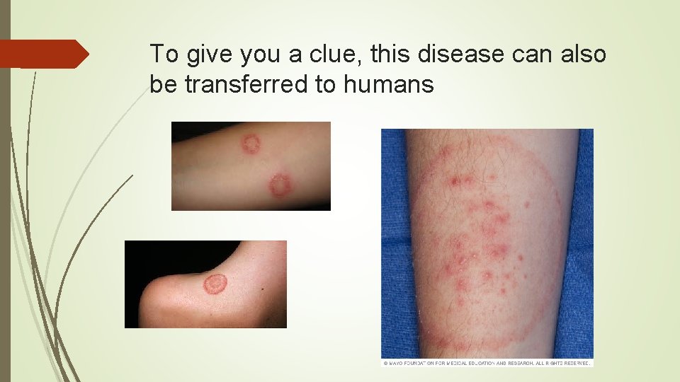 To give you a clue, this disease can also be transferred to humans To give you a clue, this disease can also be transferred to humans