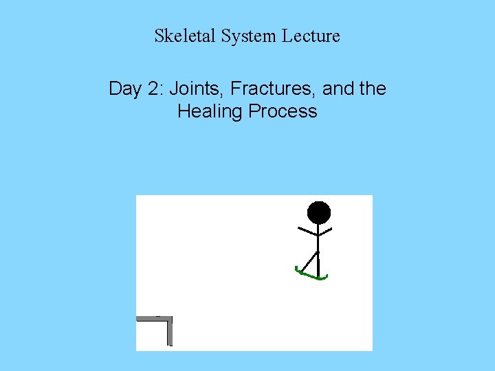 Skeletal System Lecture Day 2: Joints, Fractures, and the Healing Process 