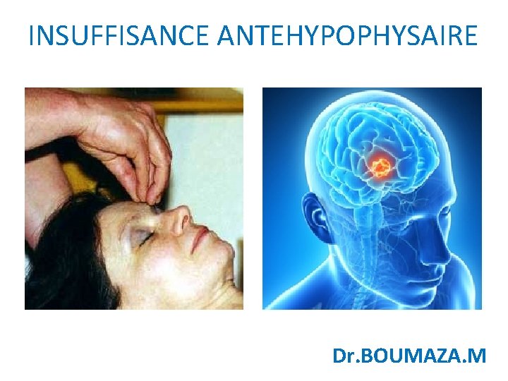 INSUFFISANCE ANTEHYPOPHYSAIRE Dr. BOUMAZA. M 