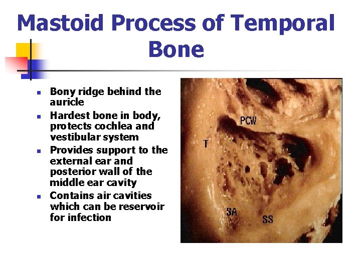 Mastoid Process of Temporal Bone n n Bony ridge behind the auricle Hardest bone Mastoid Process of Temporal Bone n n Bony ridge behind the auricle Hardest bone