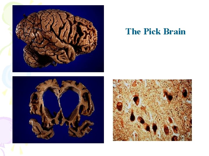 The Pick Brain 