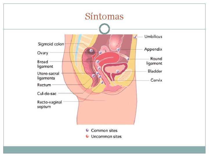 Síntomas 