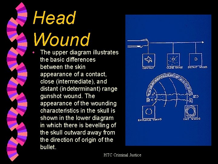 Head Wound w The upper diagram illustrates the basic differences between the skin appearance