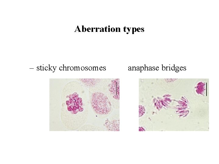 Aberration types – sticky chromosomes anaphase bridges 