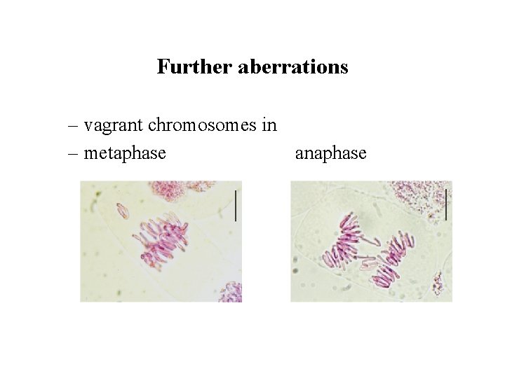 Further aberrations – vagrant chromosomes in – metaphase anaphase 