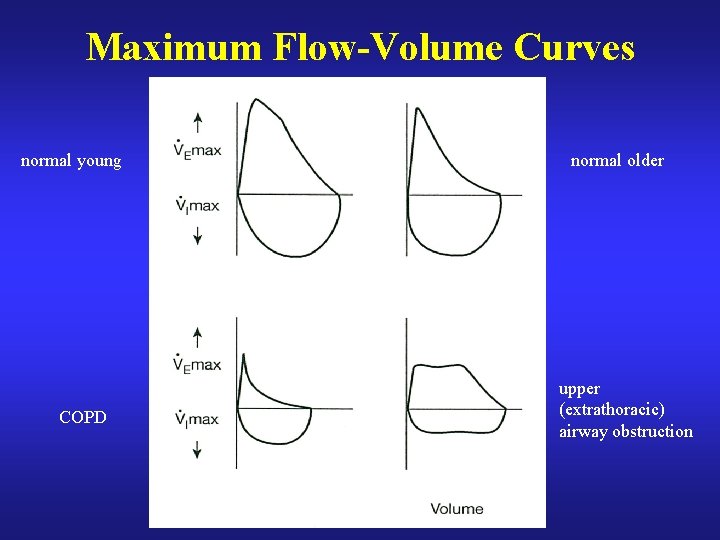 Maximum Flow-Volume Curves normal young COPD normal older upper (extrathoracic) airway obstruction 