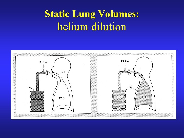 Static Lung Volumes: helium dilution 