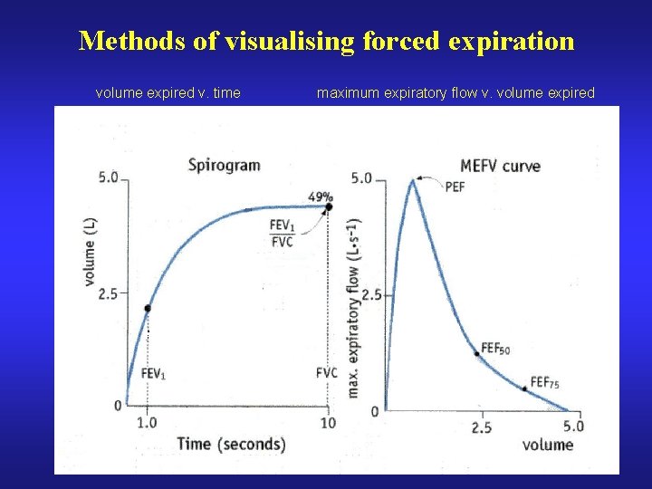 Methods of visualising forced expiration volume expired v. time maximum expiratory flow v. volume