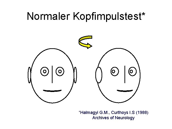 Normaler Kopfimpulstest* *Halmagyi G. M. , Curthoys I. S (1988) Archives of Neurology 