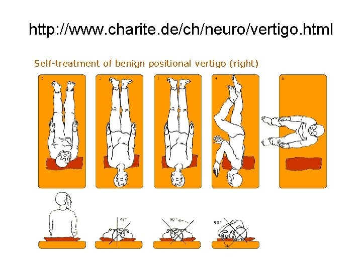 http: //www. charite. de/ch/neuro/vertigo. html 